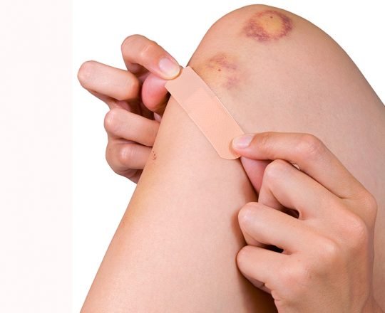 Curativo que muda de cor dá aviso precoce de infecção