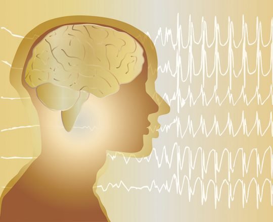 Epilepsia: causas, sintomas e tratamentos