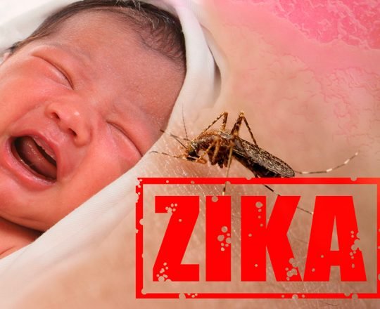 Microcefalia: causas, sintomas e tratamento