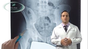 Como é feito o diagnóstico da osteoartrose do quadril?