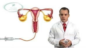 Qual o tratamento para a mulher com endometriose engravidar?