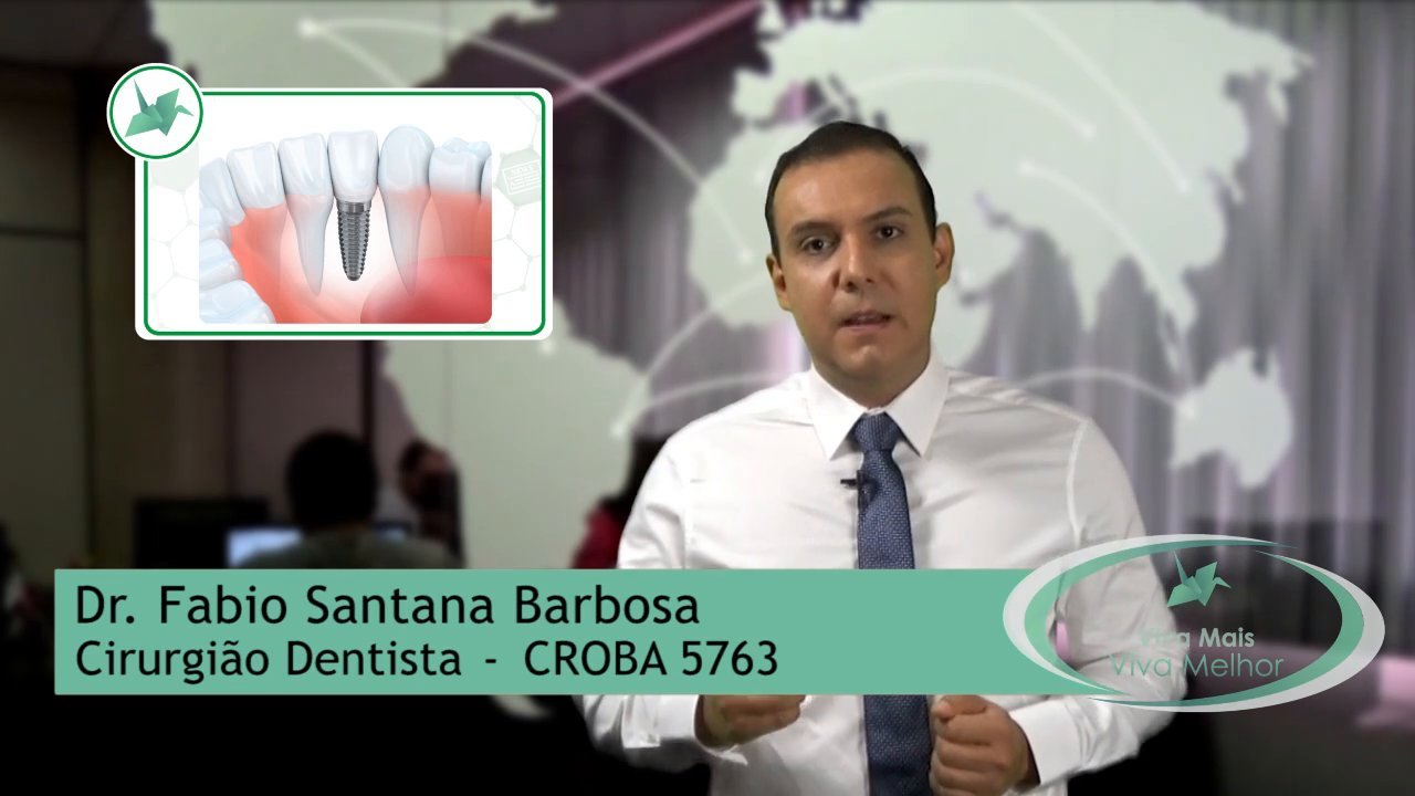 Vídeo Completo – Implante Dentário