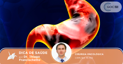 Câncer de Estômago: O que é?