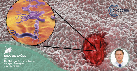 Por qual motivo é desenvolvido o câncer no estômago?