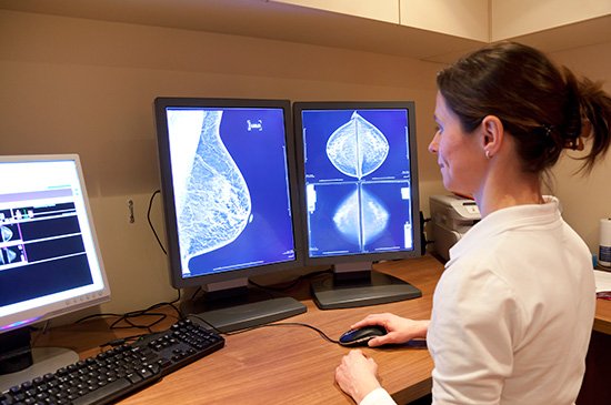 Tem idade correta para fazer a mamografia?