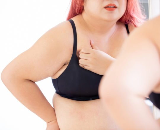Obesidade é fator de risco relevante para o câncer de mama