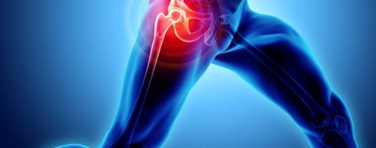 Os benefícios da artroscopia do quadril para tratamento de lesões no quadril